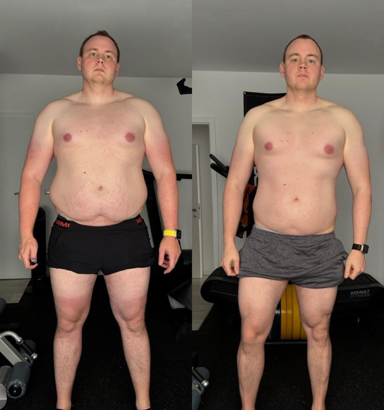 Vorher-Nachher Transformation Athlet 5b